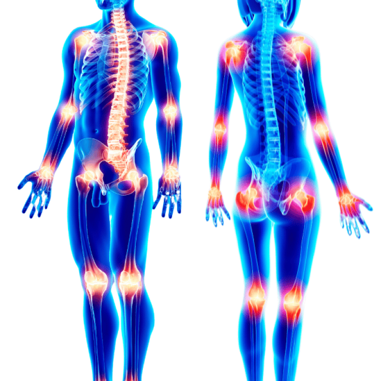 Joint & Pain Care (2)
